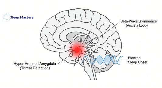 Clinical medical diagram illustrating cognitive hyper-arousal and sleep anxiety, demonstrating how an overactive amygdala and beta-wave dominance block natural sleep onset.